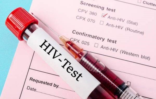 آزمایش بزاق - راه های تشخیص سریع ایدز