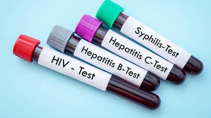 تفاوت ایدز و هپاتیت