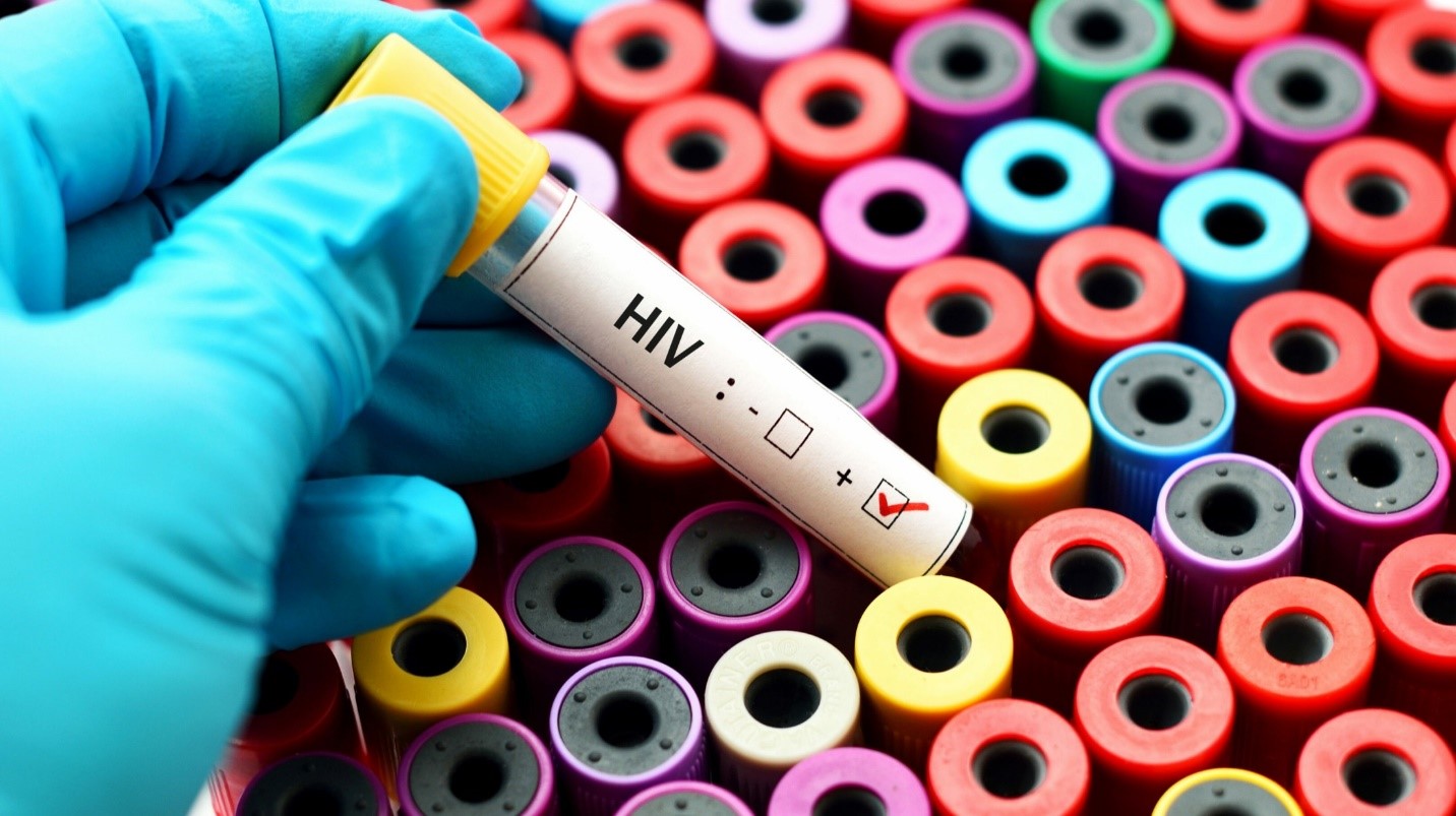 چه زمانی برای آزمایش ایدز مناسب است؟